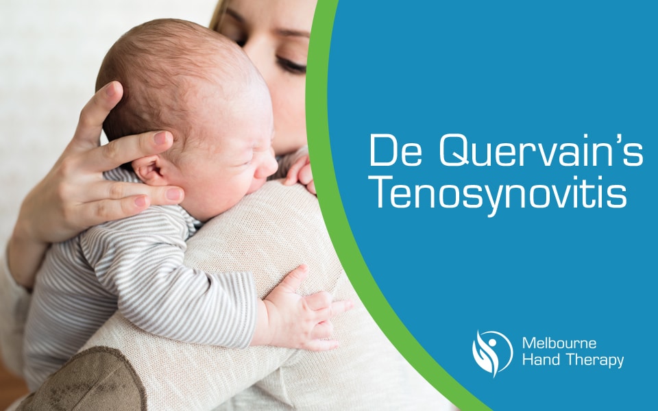 De Quervain’s Tenosynovitis: Causes, Symptoms And Treatment