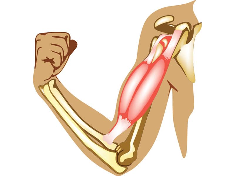 Distal Biceps Tendon Tear