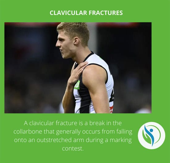 Clavicular Fracture