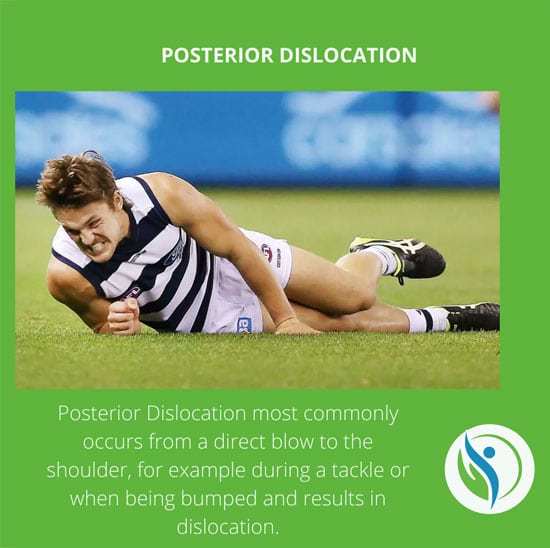 Posterior Dislocation
