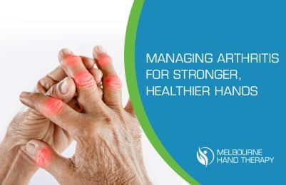 Managing Arthritis for Stronger, Healthier Hands