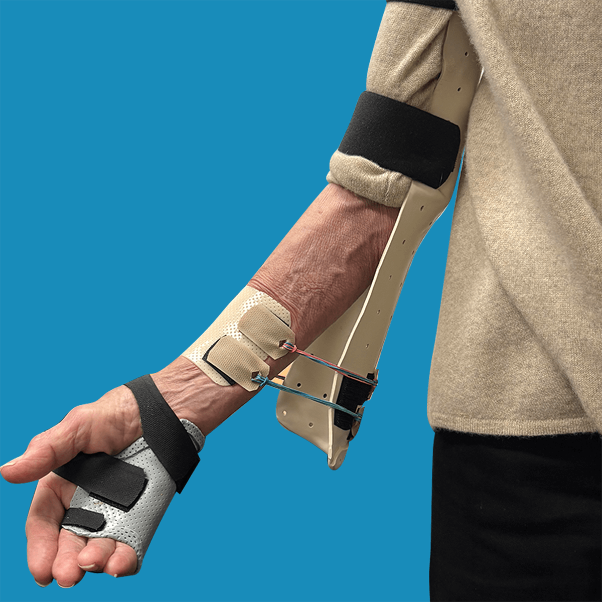Dynamic Splints