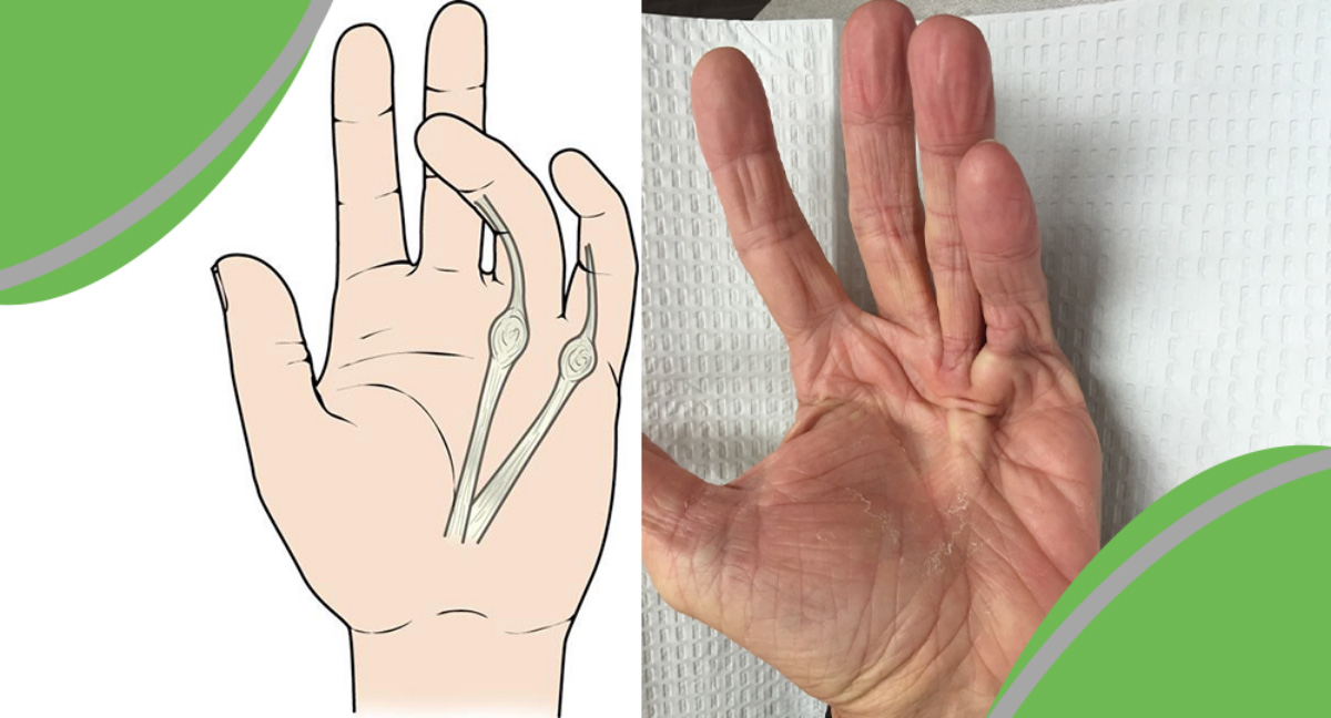 Postoperative Recovery